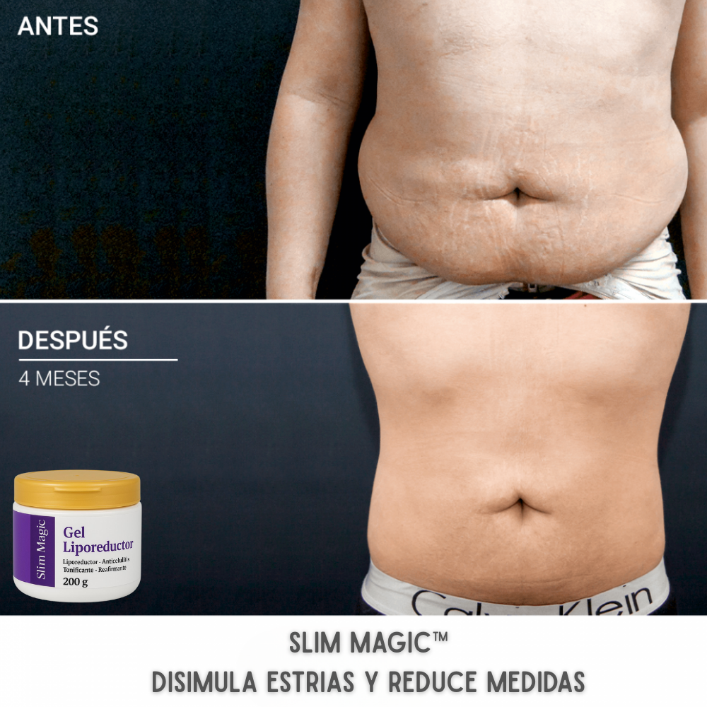 Slim Magic™ - Gel Liporeductor - 😍PRODUCTO EN TENDENCIA😍